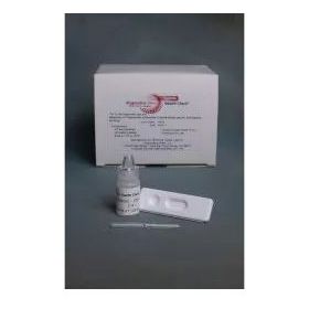 Rapid Test Kit Syphilis Health Check Infectious Disease Immunoassay Syphilis Screen Whole Blood / Serum / Plasma Sample 20 Tests