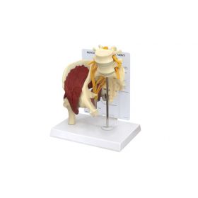 GPI Anatomicals  Muscled Hip with Sciatic Nerve Model