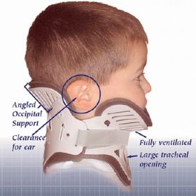 Rigid Cervical Collar NecLoc Preformed Infant (0 to 24 Months) Size P1 Two-Piece / Trachea Opening