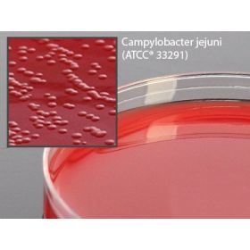 Prepared Media Cefoperazone, Vancomycin, Amphotericin B (Campy CVA) Agar with 5% Sheep Blood Petri Plate Format