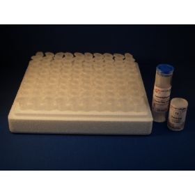 Test Kit Ery-TIC 1:200 Plus Visual Microscopic Counting Erythrocytes Whole Blood Sample 100 Tests