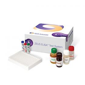 ELISA SmartKit SS-A (RO) Test System 96 Count Ea