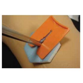Acticoat Antimicrobial Exfix Wound Dressing 6" x 10"